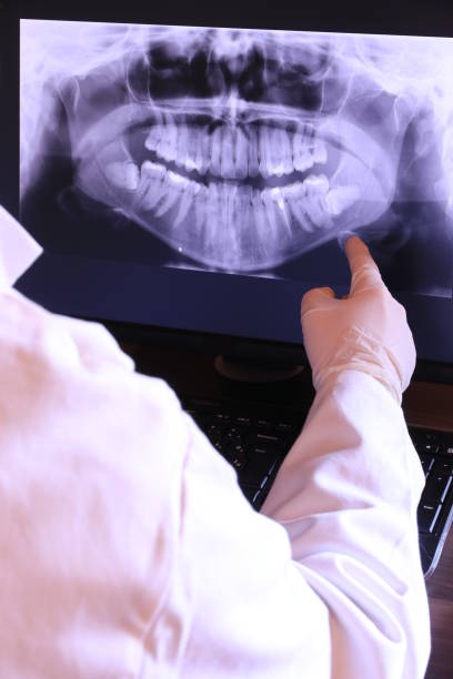 Best Emergency Dental Surgery in Lexington, MS